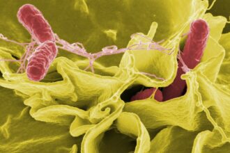 salmonela-pode-estar-no-seu-prato:-os-sinais-da-infeccao-e-dicas-de-prevencao