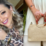 blogueira-com-vitiligo-ha-10-anos-transforma-vivencia-em-inspiracao:-‘nao-me-afeta-mais’