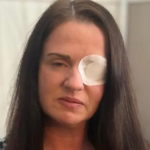 ‘tive-parada-cardiaca-e-quase-fiquei-cega-apos-esteticista-me-aplicar-botox-falso’